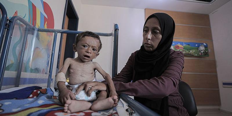 Man-Made Famine Is Starving Gaza’s Children