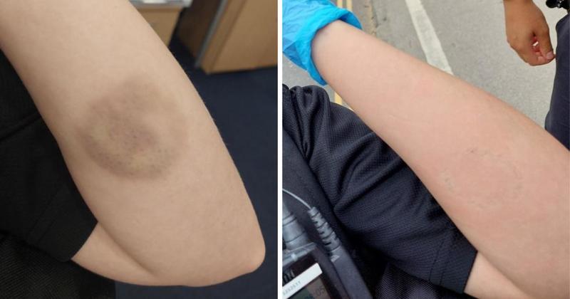 Woman in her 30s jailed after biting police officer on the arm