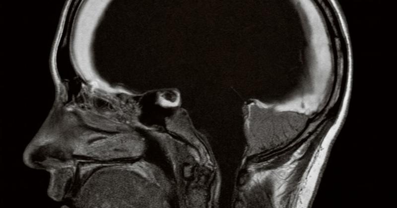 Do We Really Need a Brain?