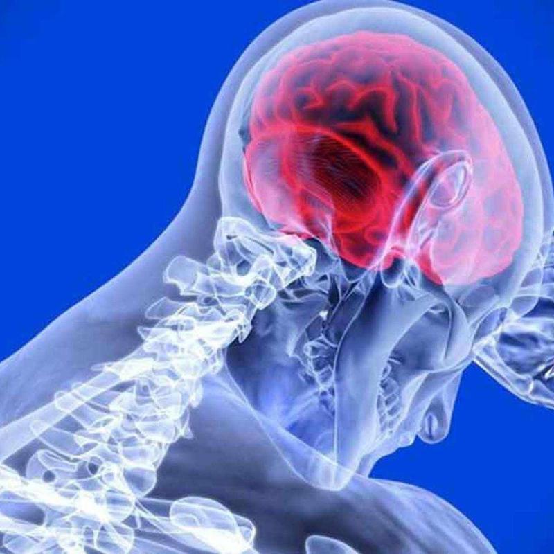 AVC mata mais que infarto no país. Veja mitos e verdades sobre a doença