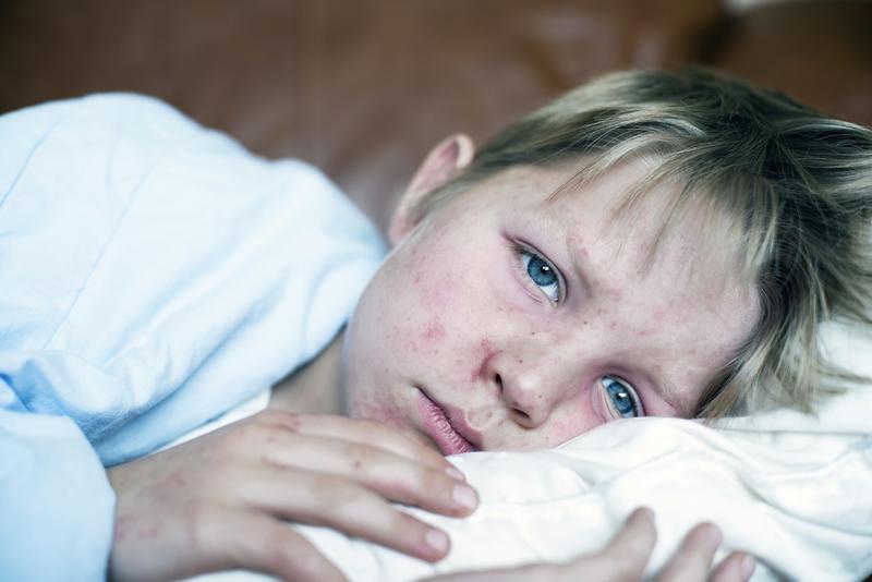New measles cases in Queensland show ‘herd immunity’ is more important than ever