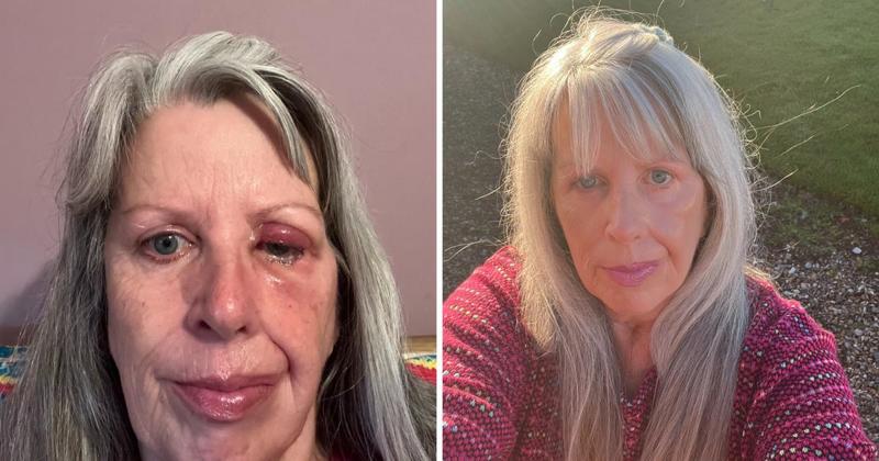 Mother to mark 10 years since life-threatening brain surgery