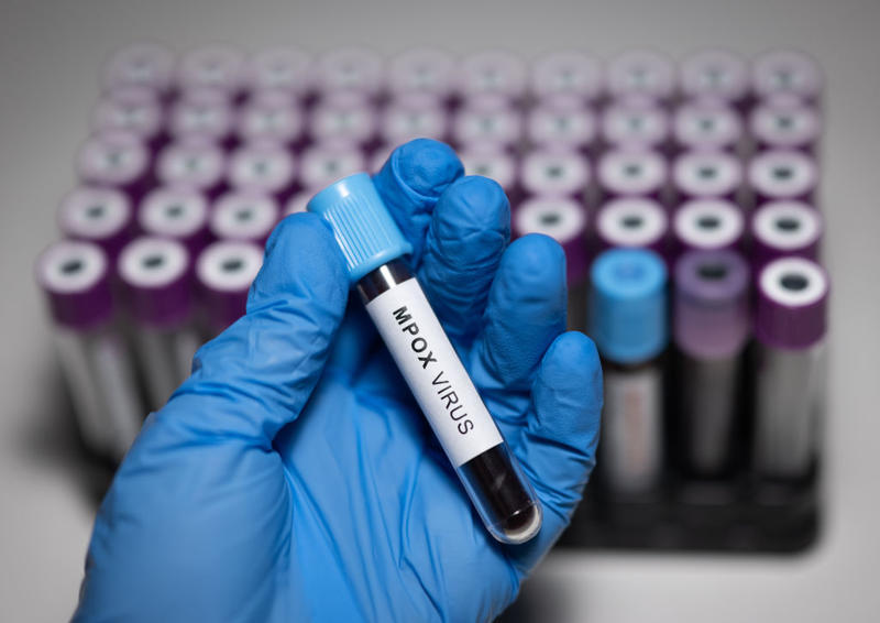 Restoring monkeypox name creates chaos