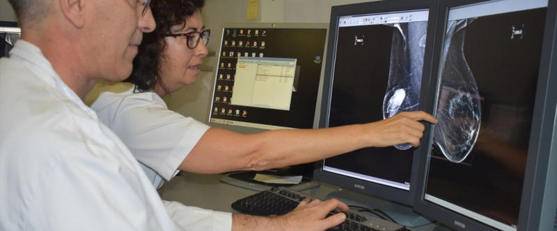 La 'punta del iceberg' de los fallos del cribado de cáncer de mama en Andalucía: 50 casos y 