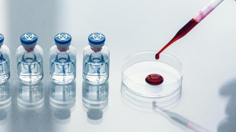The Soviet Union’s Secret Biological Weapons Program Should Give You Nightmares