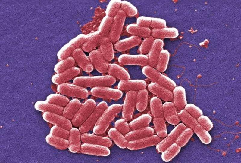 Dirty Hospitals Are to Blame for Superbug Deaths