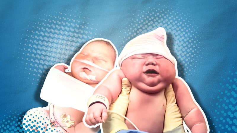 News of a ‘giant’ baby boy is all over TikTok. Here’s what women really need to know