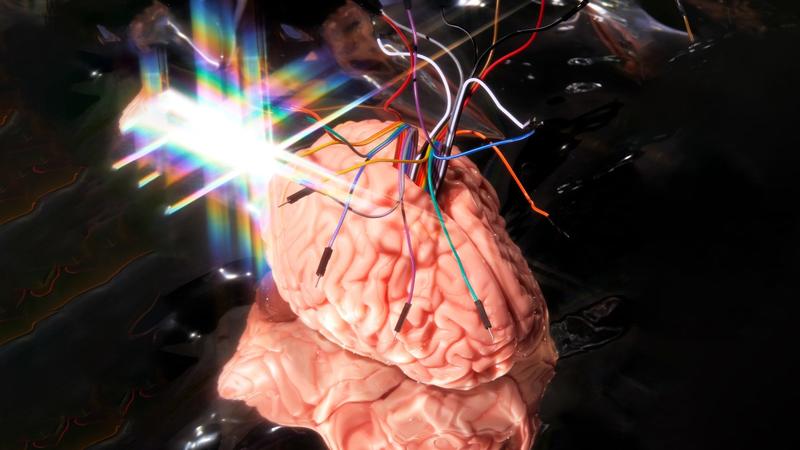 Neuralink | Elon Musks Neuralink und die Ideologie des Transhumanismus: Eine Traumverbindung