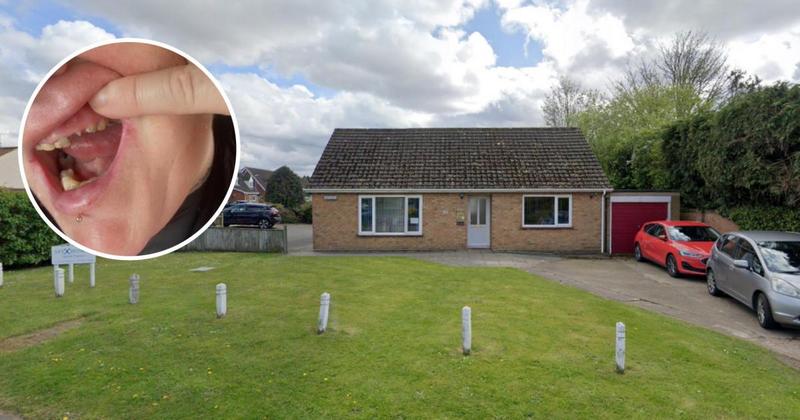 Dentist patient left in pain for six months after surgery hikes charges