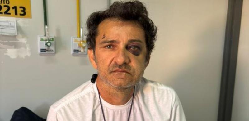 Homem que agrediu entregador no CE por 2 minutos é indiciado por tentativa de homicídio