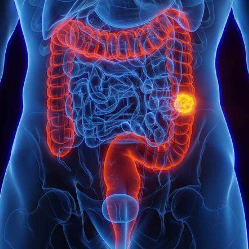 Radioisótopos: a revolução no tratamento do câncer - parte 2