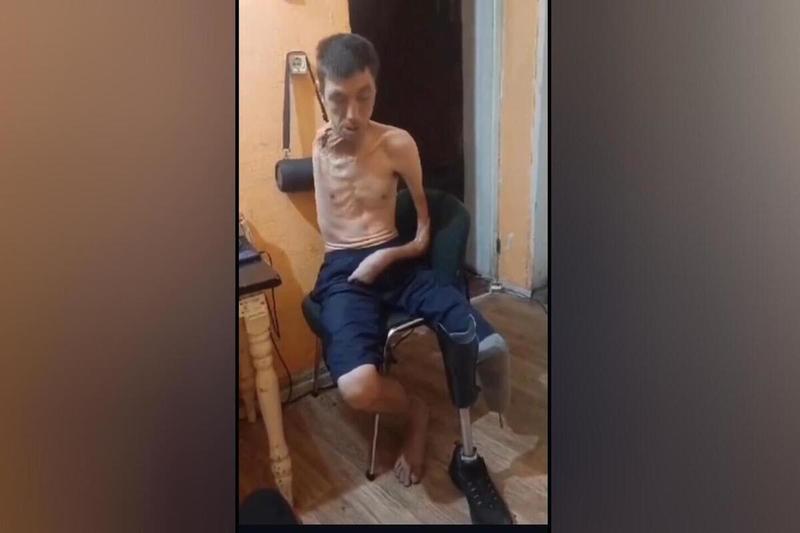 Инвалида без руки, ноги и уха отказываются освобождать из колонии