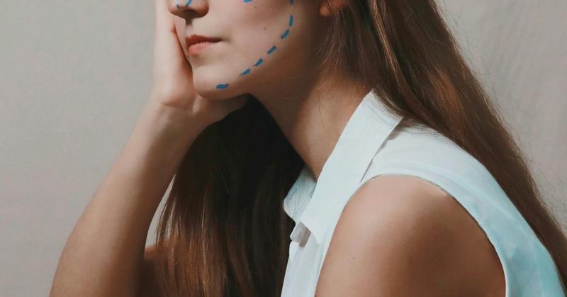 Before and After Photos Before and After Photos