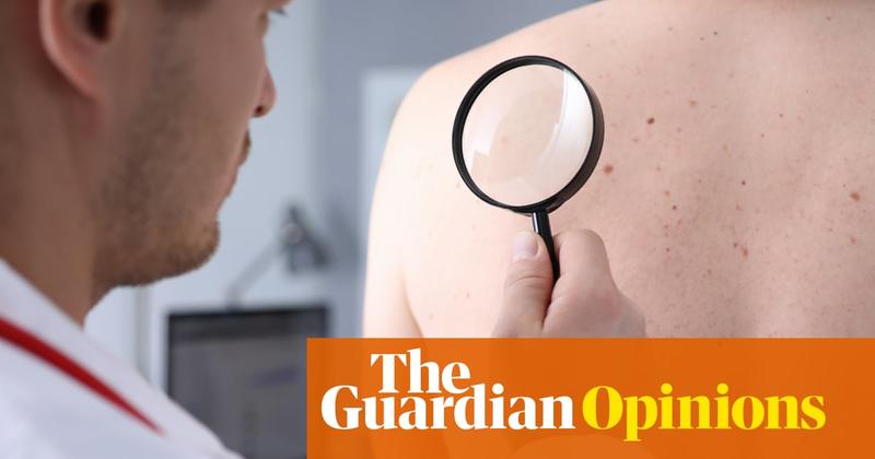 I found something strange on my back – and eventually I just couldn’t ignore it