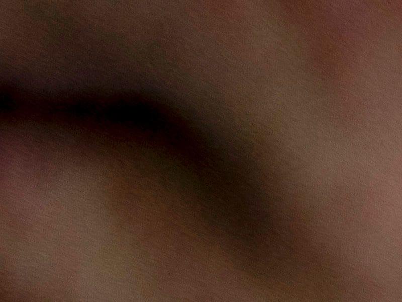 Rougeole: le Canada perd son statut Rougeole: le Canada perd son statut