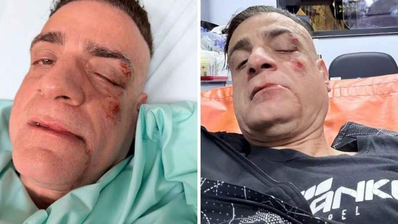 Simone Cicalone ed Evelina aggrediti a Roma: pugni e violenza allo youtuber e alla sua videomaker – Cosa è successo