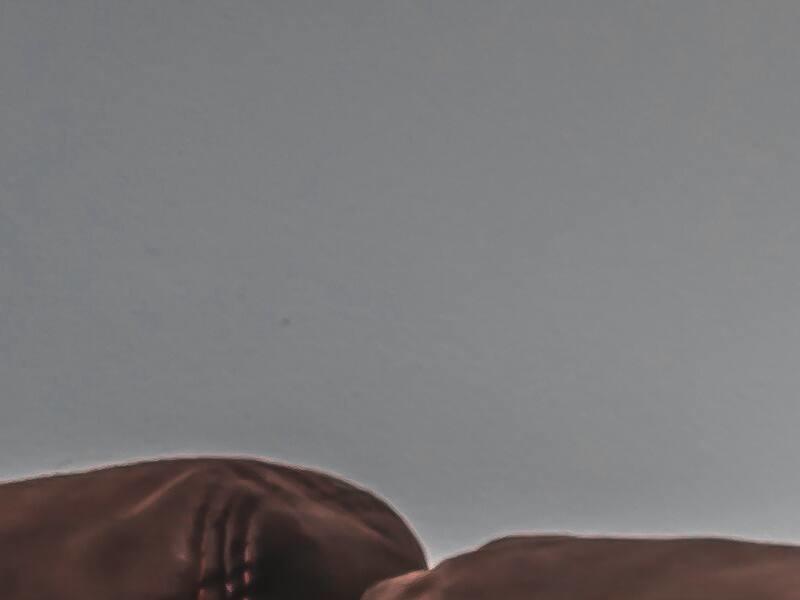 Hémorragie dans la lutte contre les agressions Hémorragie dans la lutte contre les agressions