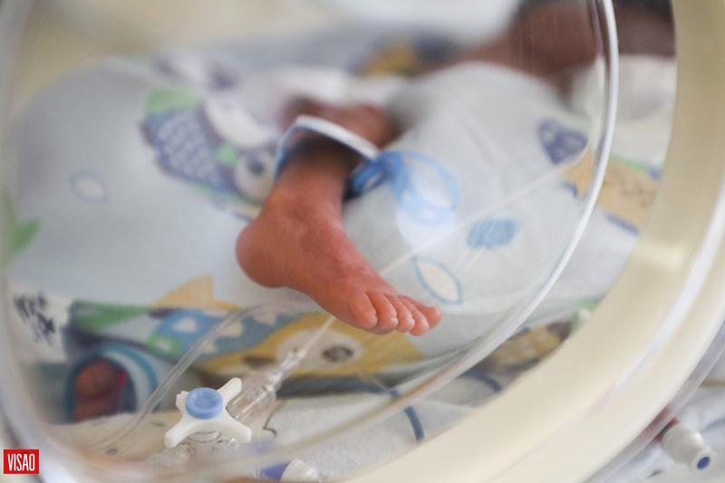 Prematuridade e desenvolvimento do bebé: A importância da intervenção precoce