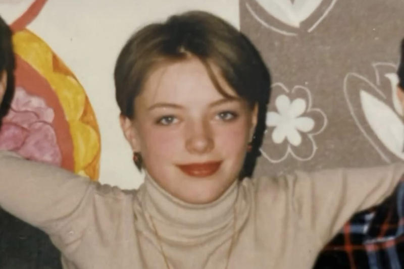 Болезнь, от которой нет эффективного лечения, изменила лицо россиянки до неузнаваемости