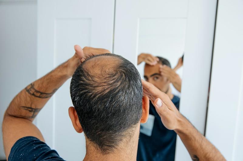 How does the hair-loss drug finasteride work? Can it affect my mental health?