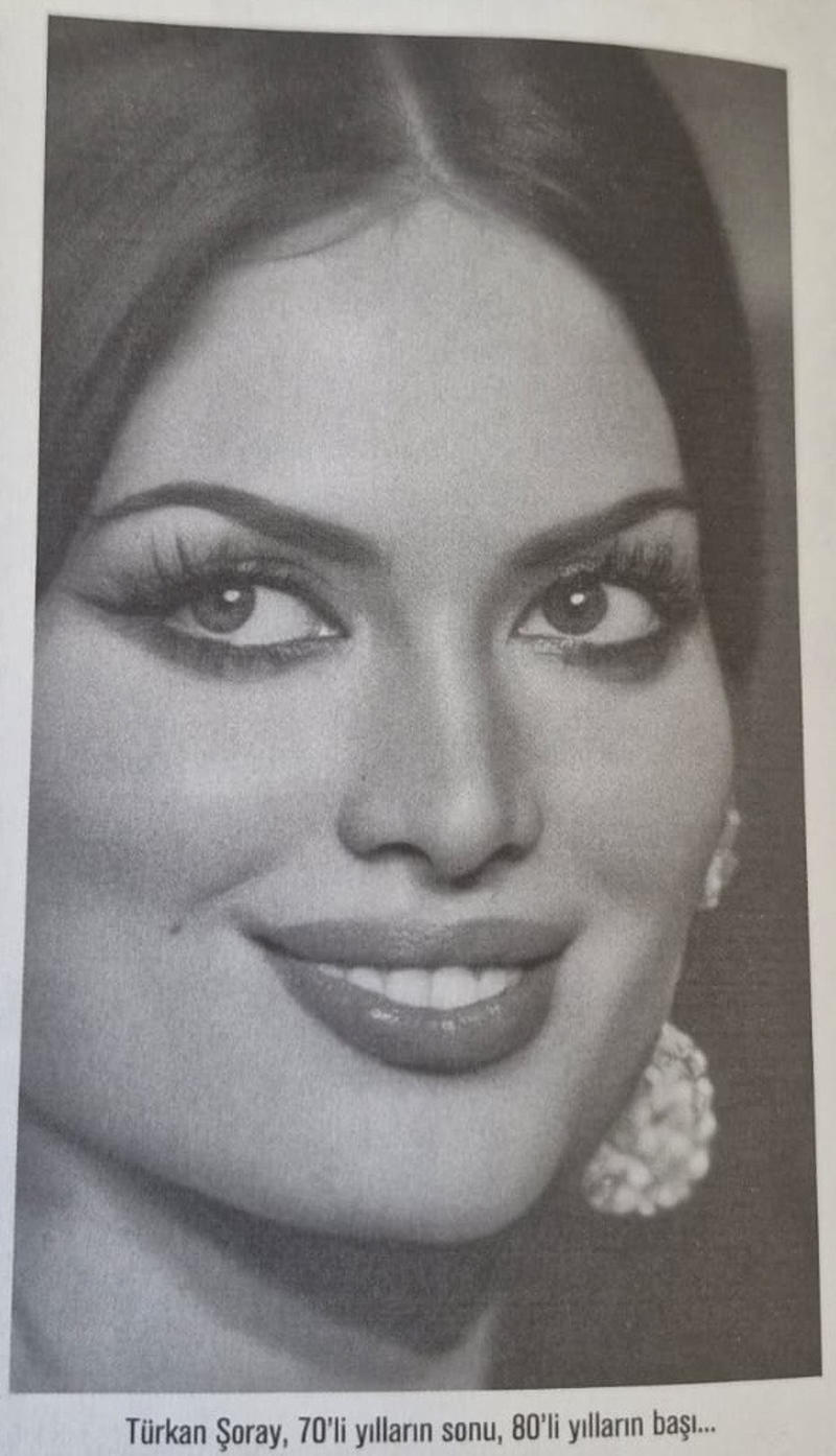 Türkan Şoray-Sezen Aksu'ya aynı teşhis: Cushing sendromu