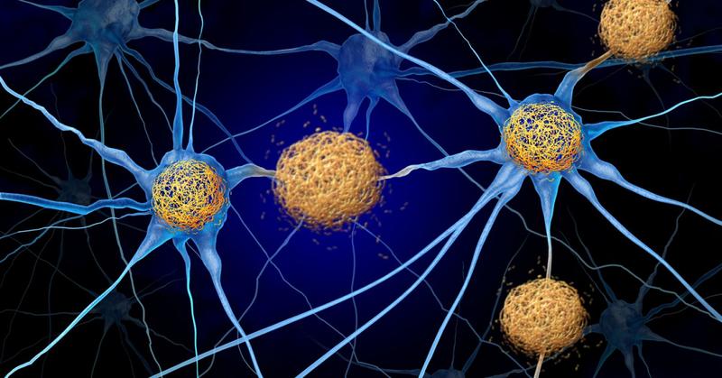 The Psychological Toll of Living with a Rare Disease