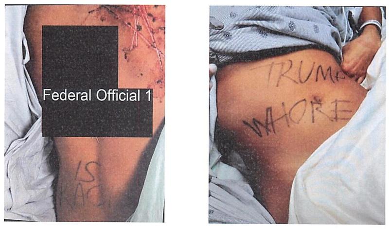 Republican Aide Charged With Faking Violent Leftist Attack on Herself