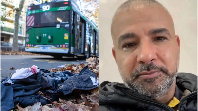 Travolto dal filobus in viale Jenner: è morto dopo due giorni d’agonia il 52enne Yousry Seif