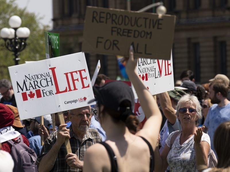 NP View: Canadians need to know more about late-term abortion policies