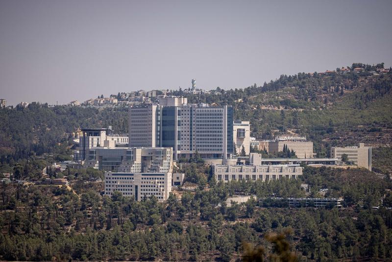 Fire at Hadassah Ein Kerem hospital prompts brief partial evacuation
