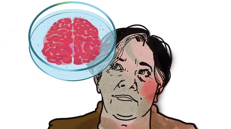 Rätsel im Blut: Die Infektion dieser Frau hat Seltenheitswert Rätsel im Blut: Die Infektion dieser Frau hat Seltenheitswert