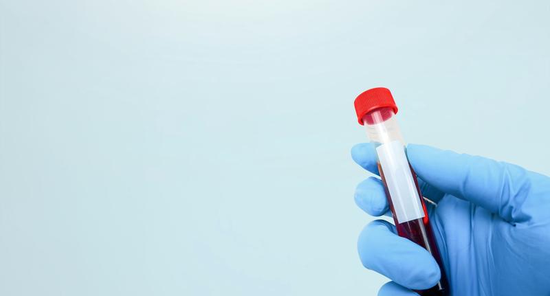 The cancer blood test making waves – and what the numbers really show