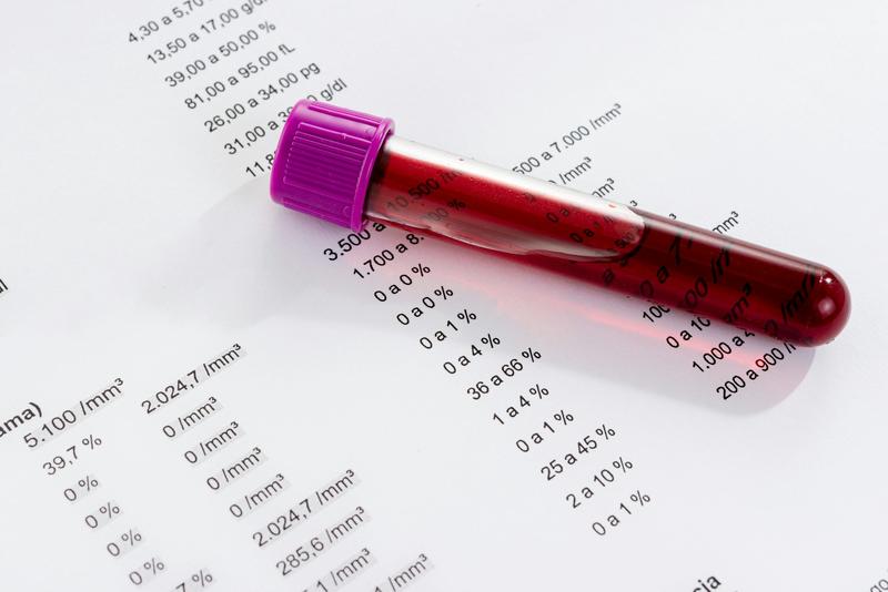 Rethinking blood test reference ranges could make medicine fairer – and safer