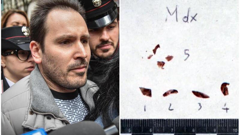 Tracce di Dna sulle unghie di Chiara Poggi: ecco come la perizia della genetista Albani rimette nei guai Sempio. La difesa: “Non è una prova”