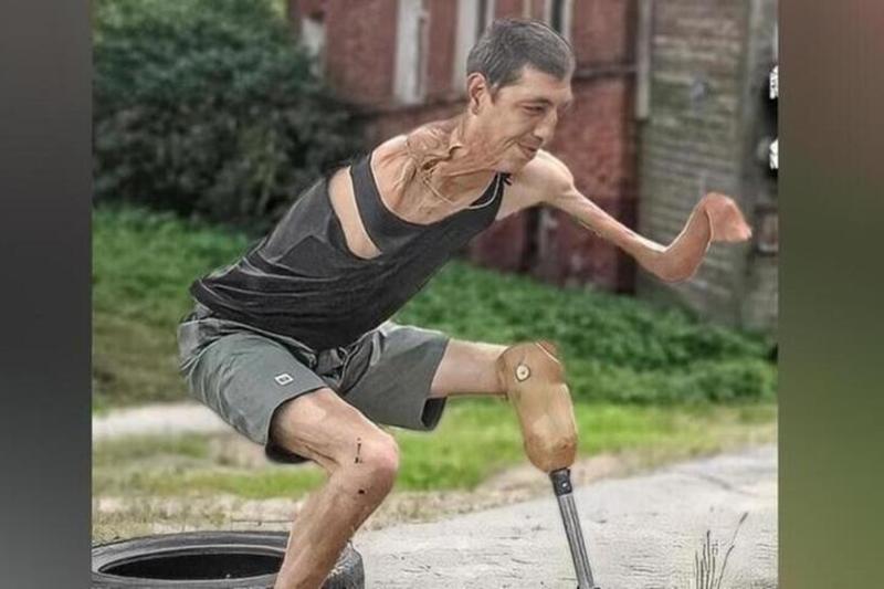 Инвалиду без рук, ноги и уха вынесли приговор медики