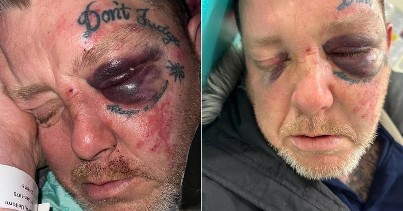 Man scared to leave his home after brutal assault speaks out Man scared to leave his home after brutal assault speaks out