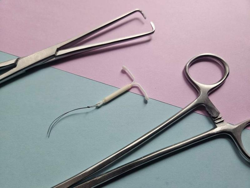 Comment: Rural doctors lead the way in making IUD insertion more comfortable