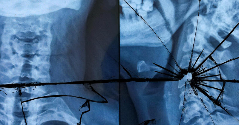 Don’t Fear Self-Driving Cars. They Save Lives.