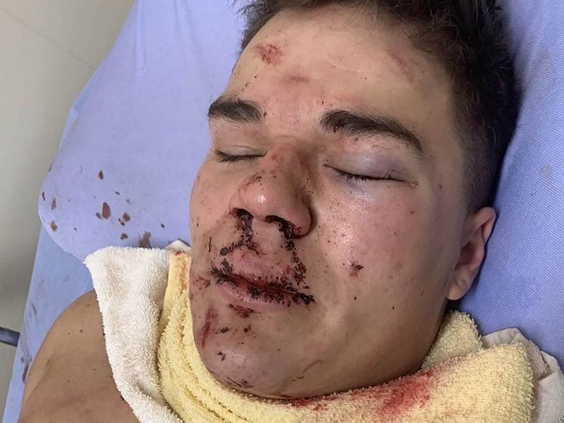 Martin: Judge makes logical ruling in sparing convicted killer prison term in Banff assault