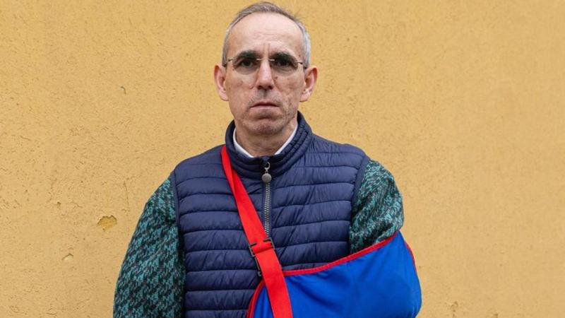 Pestato fuori dal locale: “Riempito di botte per aver difeso un cliente”