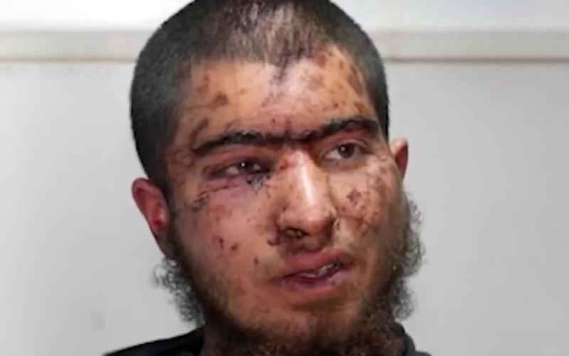 IDF probing reservists who allegedly beat Palestinian teen, causing ‘disturbing’ injuries