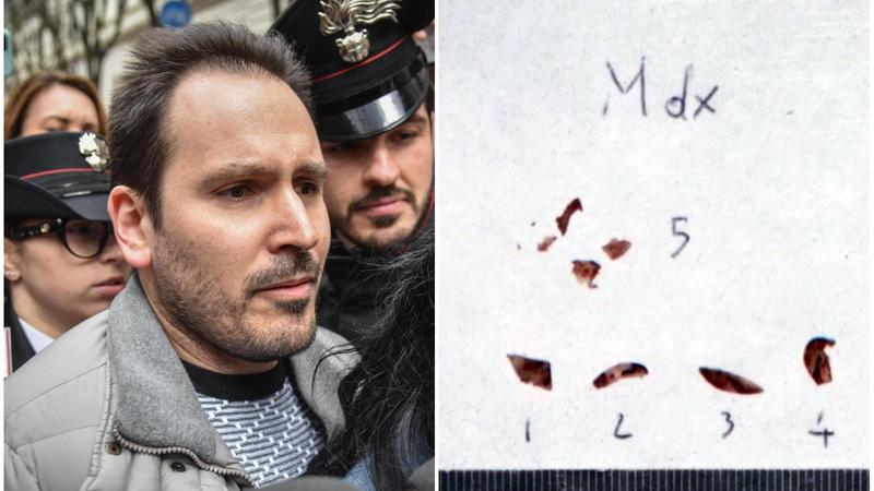 Garlasco, le tracce di Dna attribuibile a Sempio erano sopra o sotto le unghie di Chiara? Perché la partita è decisiva e ancora aperta