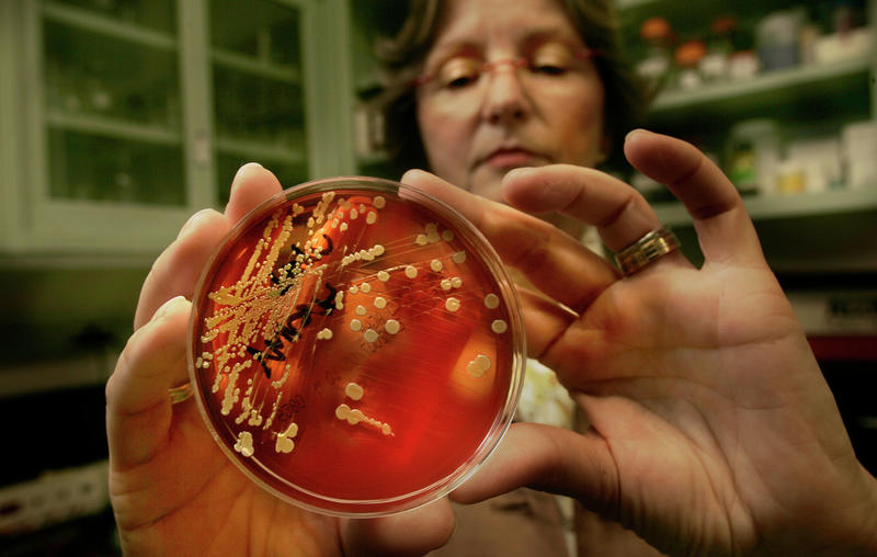 California is becoming ground zero for America’s superbug crisis