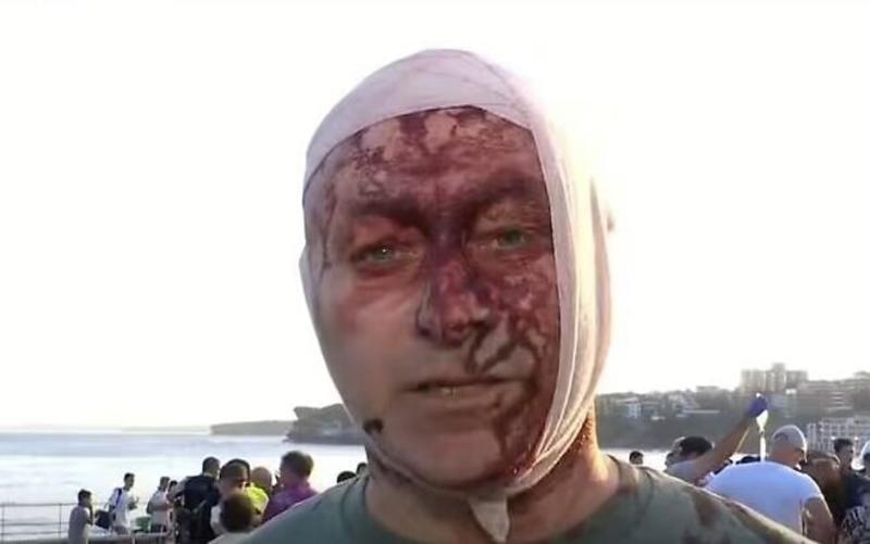 ‘It was a bloodbath. I saw children falling’: Eyewitnesses describe Sydney terror attack ‘It was a bloodbath. I saw children falling’: Eyewitnesses describe Sydney terror attack