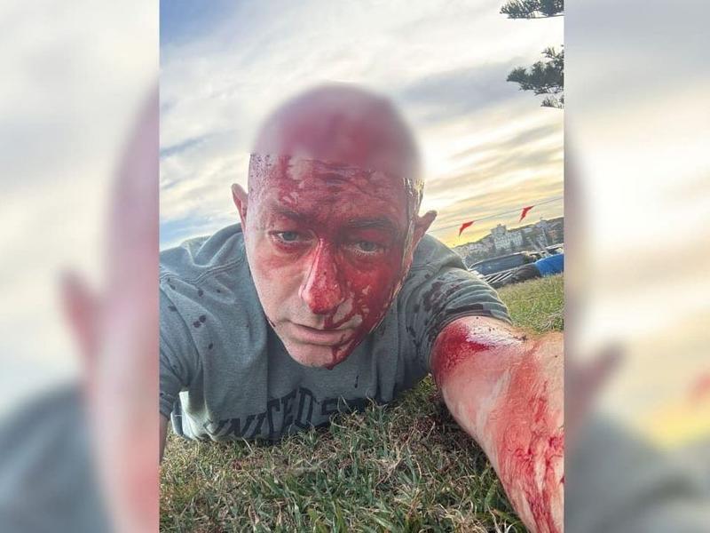 Rick Ekstein: Mark Carney has inflamed antisemitism. Will Canada too pay a price?