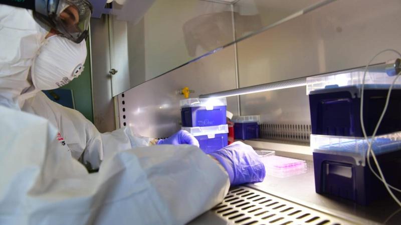 Malattie neurologiche, lo studio dei danni e lo sviluppo di nuove terapie: al via un nuovo progetto