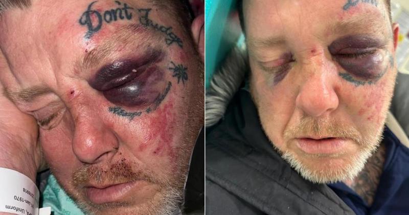 Suspect released on bail after 'Good Samaritan' attack Suspect released on bail after 'Good Samaritan' attack