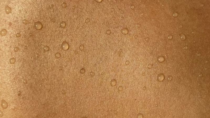 Contro le lesioni della pelle la prevenzione è essenziale