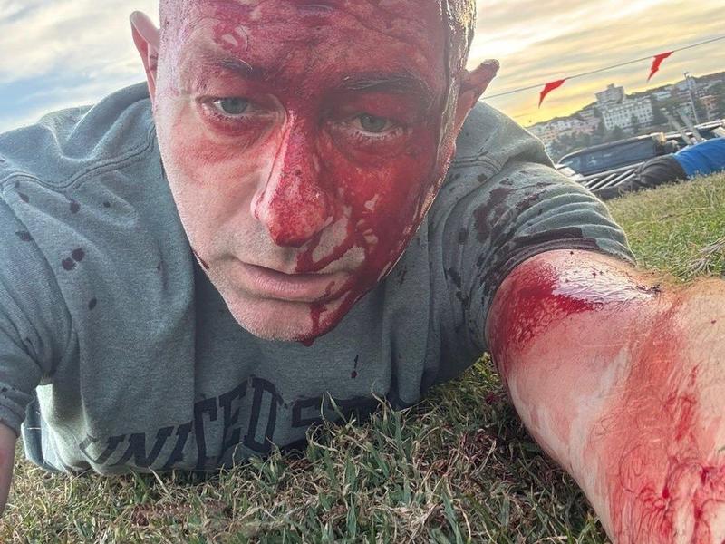 KINSELLA: How we respond to Bondi Beach massacre matters