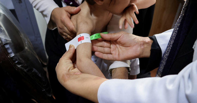 Afghan hunger crisis deepens as aid funding falls short, UN says